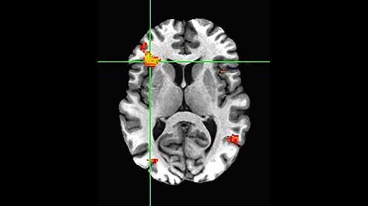 MultiBand SENSE, fMRI matching facial expressions