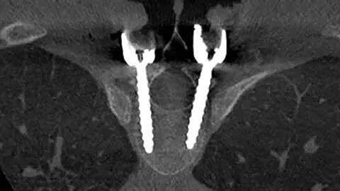 SmartCT cone-beam CT