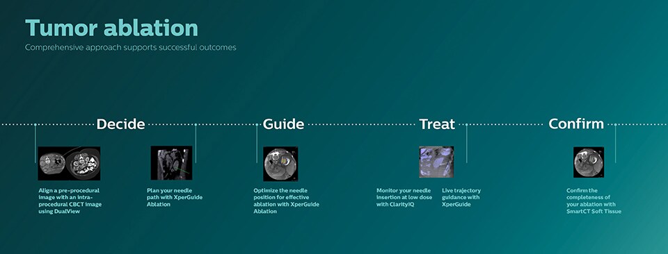 Tumor ablation infographic