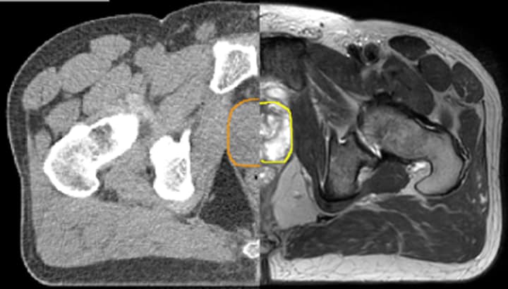 Excellent soft-tissue contrast