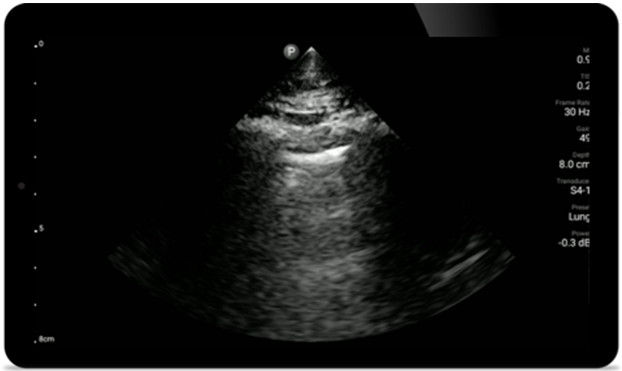 Pulmonary assessment