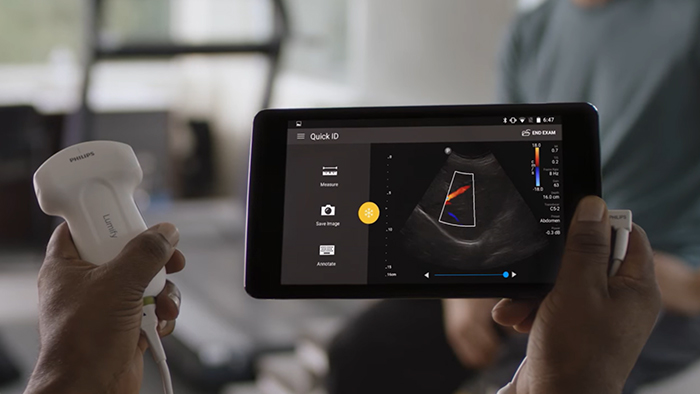 Philips Lumify - Ultrasound on your compatible smart device