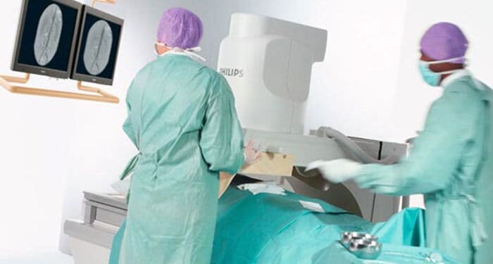 Fluoroscopy X-ray management in ASD