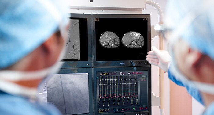 Interventional X-ray