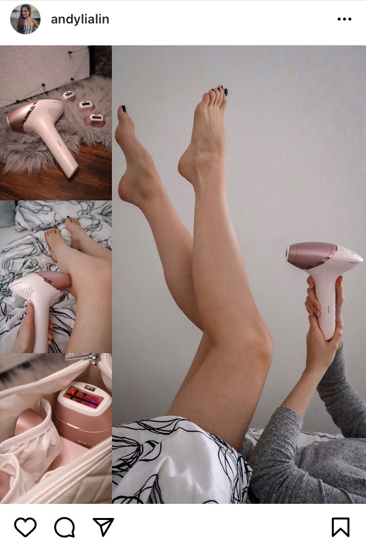 linhartova Philips Lumea
